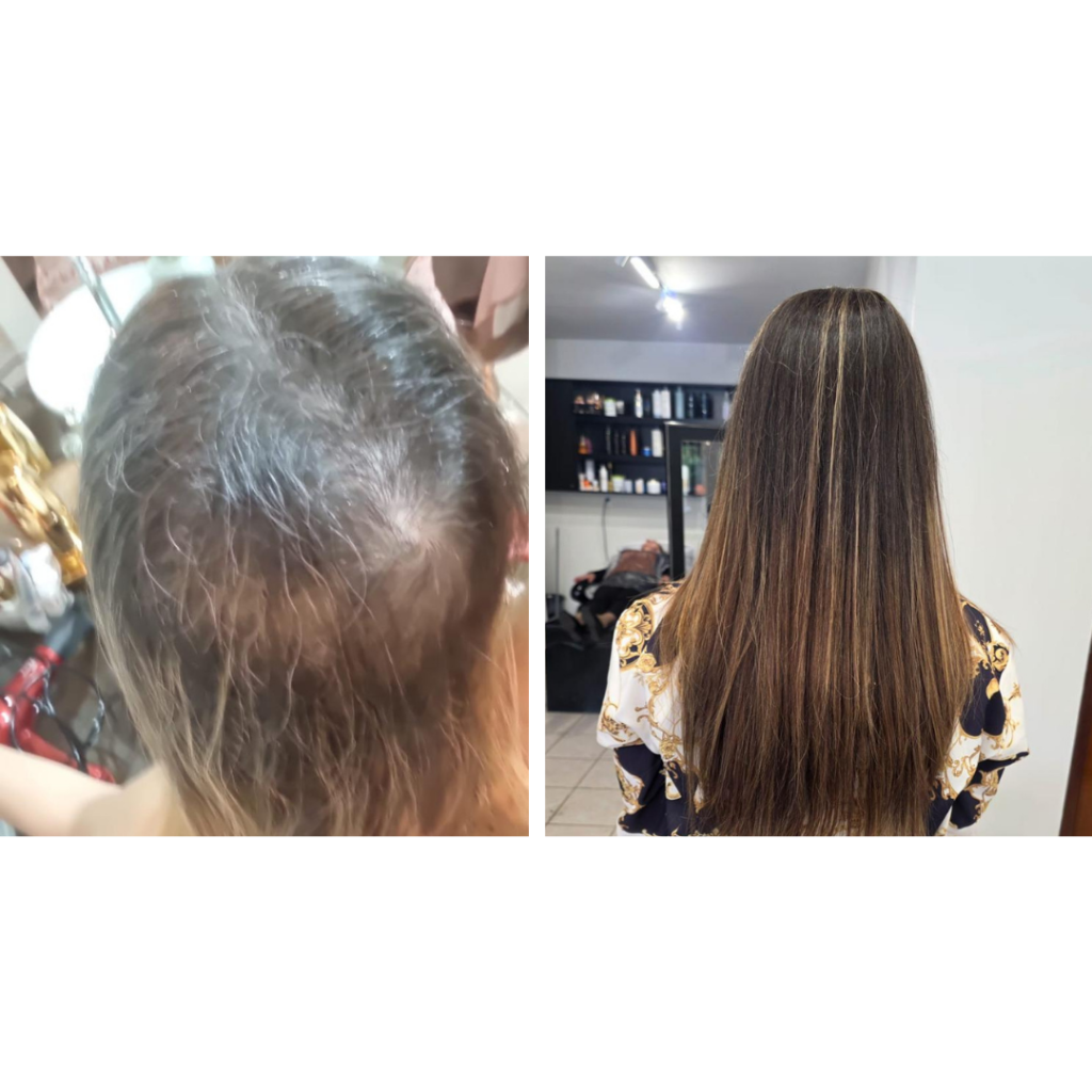 Antes e Depois